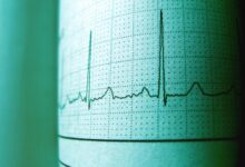 cbd impact on heart rate