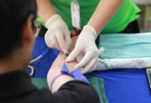 cbd use during nursing